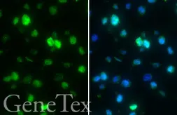 SARS-CoV-2 (COVID-19) Envelope FFPE 293T cell pellet Block. GTX435642