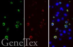 SARS-CoV-2 (COVID-19) Spike S1 FFPE 293T cell pellet block. GTX435643