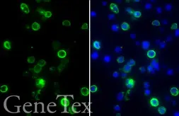 SARS-CoV-2 (COVID-19) Membrane FFPE 293T cell pellet Block. GTX435645