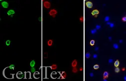 SARS-CoV-2 (COVID-19) Spike FFPE 293T cell pellet slide. GTX435744