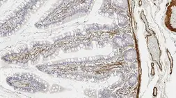 Anti-alpha Smooth Muscle Actin antibody [αsm-1] used in IHC (Paraffin sections) (IHC-P). GTX44499