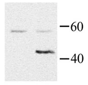 Anti-G protein alpha 16 antibody used in Western Blot (WB). GTX44501