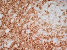 Anti-CD4 antibody [RPA-T4] (Low endotoxin, azide free) used in IHC (Frozen sections) (IHC-Fr). GTX44537
