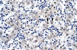 Anti-CDX4 antibody, C-term used in IHC (Paraffin sections) (IHC-P). GTX44611