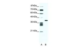 Anti-ALX4 antibody, N-term used in Western Blot (WB). GTX44617
