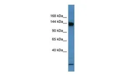 Anti-Basonuclin 1 antibody, C-term used in Western Blot (WB). GTX44618