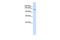 Anti-Atrophin 1 antibody, N-term used in Western Blot (WB). GTX44620