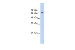 Anti-BTBD14A antibody, N-term used in Western Blot (WB). GTX44625