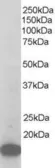 Anti-p21-ARC antibody, C-term used in Western Blot (WB). GTX44635