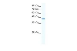 Anti-ALX4 antibody, C-term used in Western Blot (WB). GTX44637