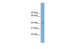 Anti-ACD antibody, C-term used in Western Blot (WB). GTX44638