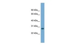 Anti-ABT1 antibody, Internal used in Western Blot (WB). GTX44651