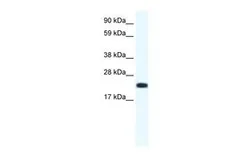 Anti-CITED4 antibody, N-term used in Western Blot (WB). GTX44655