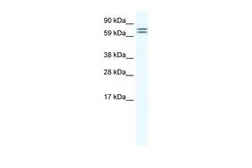 Anti-CES6 antibody, Internal used in Western Blot (WB). GTX44659