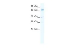 Anti-ALX3 antibody, N-term used in Western Blot (WB). GTX44663