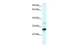 Anti-CDX1 antibody, C-term used in Western Blot (WB). GTX44665