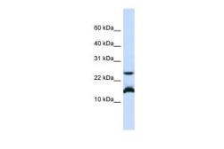 Anti-BATF antibody, N-term used in Western Blot (WB). GTX44666