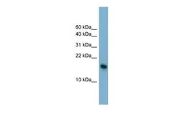 Anti-BATF3 antibody, N-term used in Western Blot (WB). GTX44669