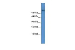 Anti-ABCA7 antibody, Internal used in Western Blot (WB). GTX44680