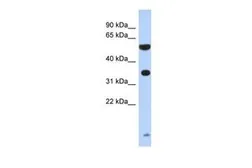 Anti-ESSPL antibody, N-term used in Western Blot (WB). GTX44834