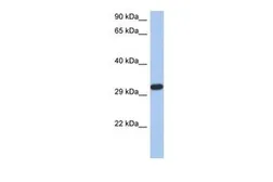 Anti-CAPZA3 antibody, N-term used in Western Blot (WB). GTX44837