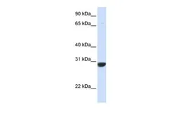 Anti-PNPO antibody, N-term used in Western Blot (WB). GTX44844