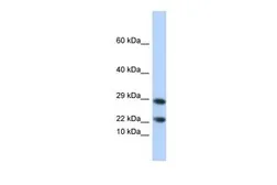 Anti-LCN8 antibody, N-term used in Western Blot (WB). GTX44849