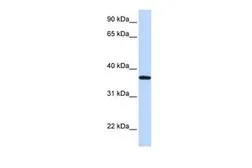 Anti-LCN12 antibody, N-term used in Western Blot (WB). GTX44850