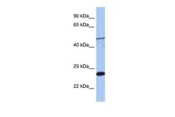 Anti-MIS12 antibody, Internal used in Western Blot (WB). GTX44858