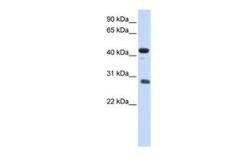 Anti-CDCA5 antibody, Internal used in Western Blot (WB). GTX44862