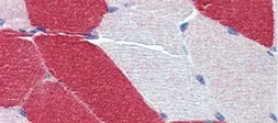 Anti-MYL6 antibody, Internal used in IHC (Paraffin sections) (IHC-P). GTX44875