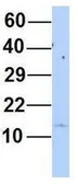 Anti-MYL6 antibody, N-term used in Western Blot (WB). GTX44876