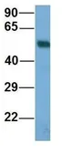 Anti-BBS4 antibody, N-term used in Western Blot (WB). GTX44878