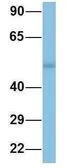 Anti-TINAGL1 antibody, Internal used in Western Blot (WB). GTX44884