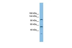Anti-CHTF18 antibody, Internal used in Western Blot (WB). GTX44891