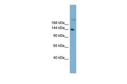Anti-WDR35 antibody, N-term used in Western Blot (WB). GTX44907