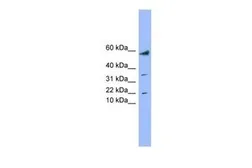 Anti-LYRM1 antibody, Internal used in Western Blot (WB). GTX44917