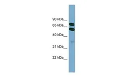 Anti-KLHL9 antibody, Internal used in Western Blot (WB). GTX44932