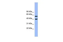 Anti-ALLC antibody, N-term used in Western Blot (WB). GTX44944
