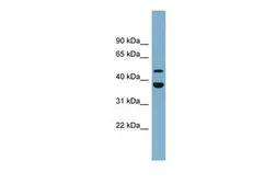 Anti-UFSP2 antibody, Internal used in Western Blot (WB). GTX44949