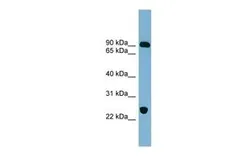 Anti-VPS53 antibody, Internal used in Western Blot (WB). GTX44953