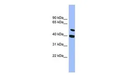 Anti-SMU1 antibody, N-term used in Western Blot (WB). GTX44960
