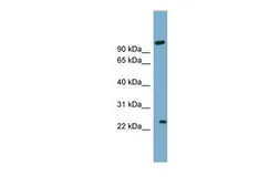 Anti-ARL8B antibody, Internal used in Western Blot (WB). GTX44968
