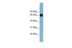 Anti-RIC8B antibody, Internal used in Western Blot (WB). GTX44970