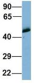 Anti-WIPI1 antibody, Internal used in Western Blot (WB). GTX44982