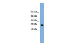 Anti-PNRC2 antibody, Internal used in Western Blot (WB). GTX44986