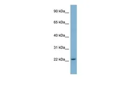 Anti-MAGP1 antibody, N-term used in Western Blot (WB). GTX44997