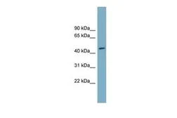 Anti-FAM53C antibody, N-term used in Western Blot (WB). GTX44999