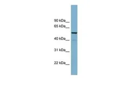 Anti-CDK5RAP1 antibody, N-term used in Western Blot (WB). GTX45006