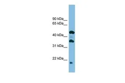 Anti-C11orf73 antibody, Internal used in Western Blot (WB). GTX45007